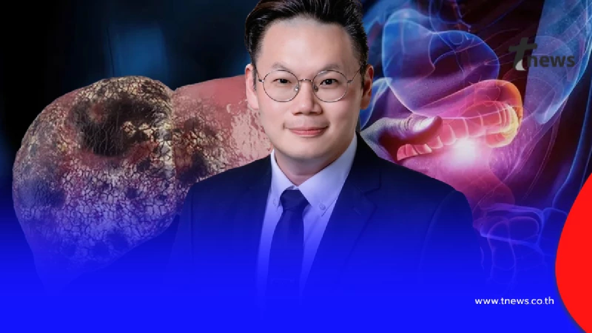 5 สัญญาณเงียบ "มะเร็งตับระยะแรก" หลายคนมารู้อีกที ก็สายไปแล้ว