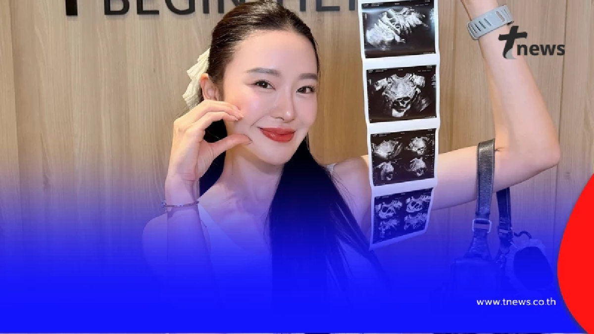 "มายด์ ณภศศิ" ประกาศข่าวดีโชว์ภาพอัลตราซาวด์ แฟนๆ คอมเมนต์เพียบ