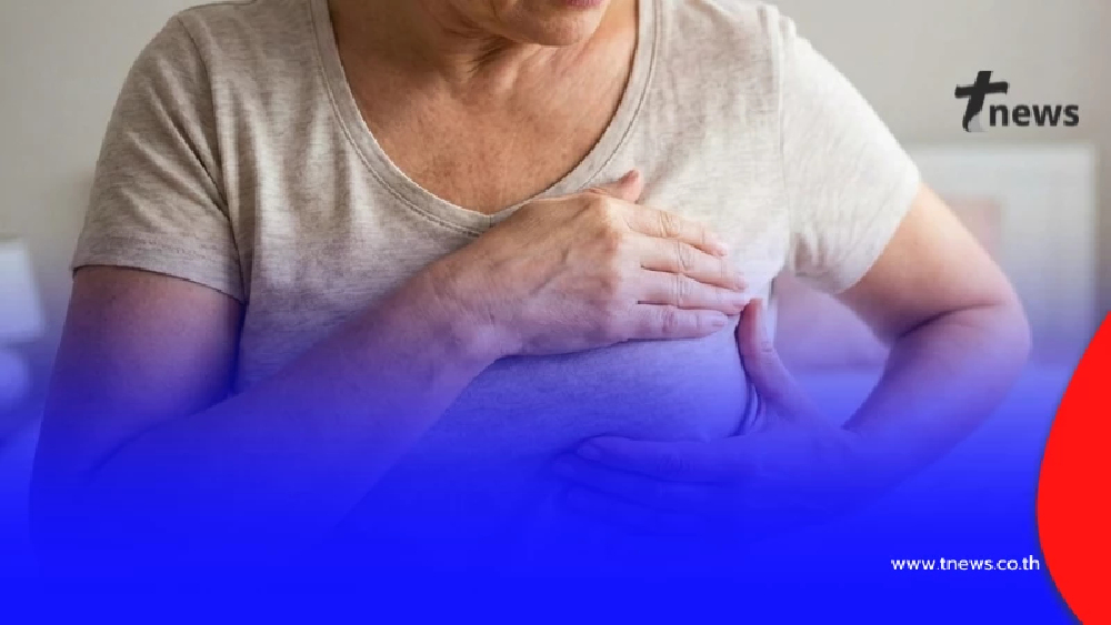 คนไข้วัย 57 ดูแลสุขภาพดี ยังเจอมะเร็งเต้านม หมอชี้สาเหตุสำคัญ