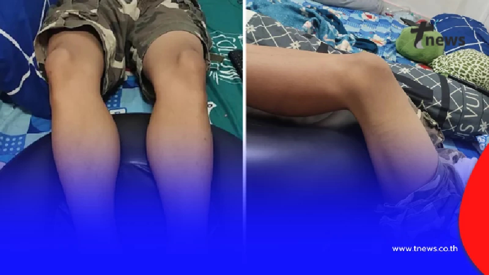 ส่องานเข้า ครูลงโทษ นร. ลุกนั่ง 800 ครั้ง เข้าข่ายผิด พ.ร.บ.ทรมานฯ