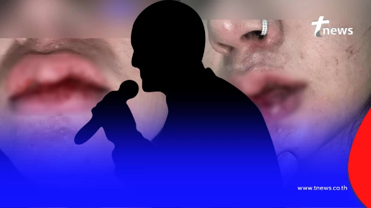 เจอตัวแล้ว นักร้องดัง ฉายา "ลูกชิ้นมีหู" โดนแฉ ทำร้ายร่างกายแฟน