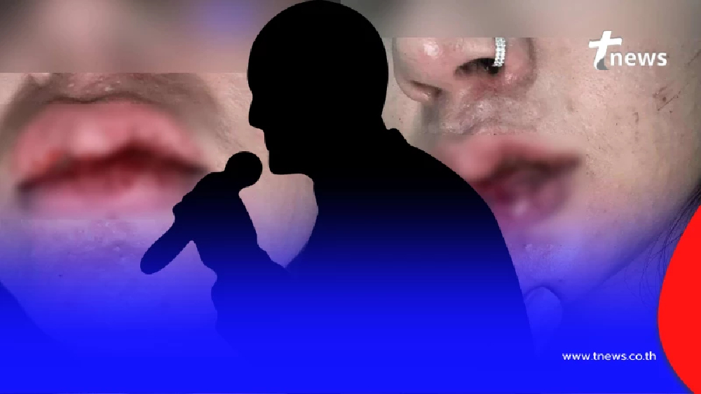 เจอตัวแล้ว นักร้องดัง ฉายา "ลูกชิ้นมีหู" โดนแฉ ทำร้ายร่างกายแฟน