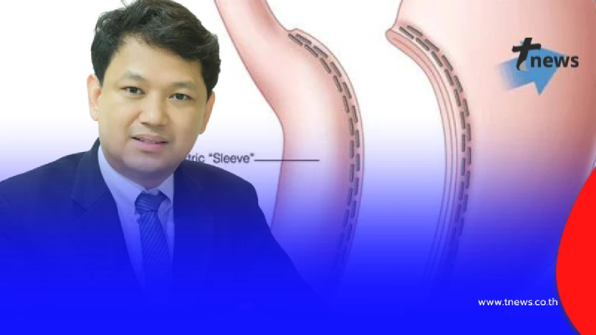 หมอเปิดความจริง ตัดกระเพาะลดความอ้วน อ่านให้ชัดก่อนตัดสินใจ