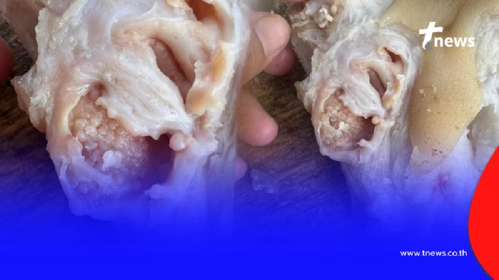 สาวสยอง เจอเม็ดใสๆในขาหมู โพสต์ถามชาวเน็ตแห่เตือนสนั่น