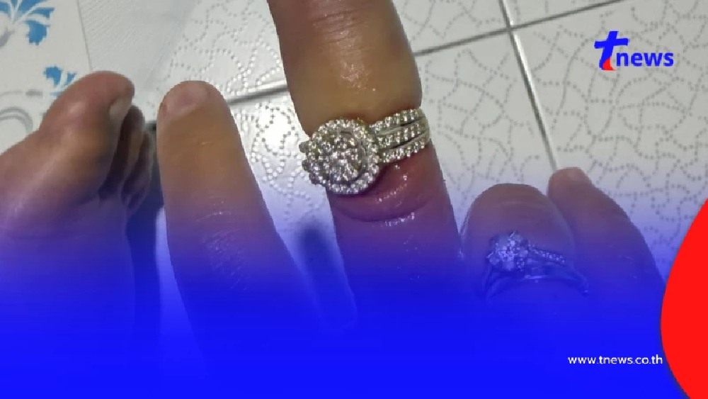 คุณแม่ท้องแฝด เผยอาการสุดพีค ไตรมาสสุดท้าย แหวนแน่นจนถอดไม่ออก