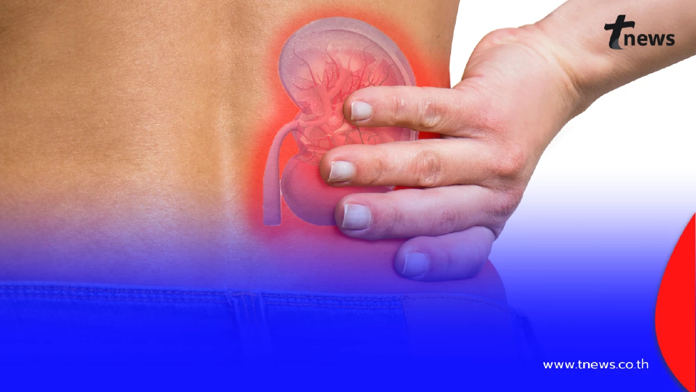 ยอดป่วยทะลุล้าน! 5 กลุ่มเสี่ยงโรคไต ไม่ตรวจระวังสายเกินแก้