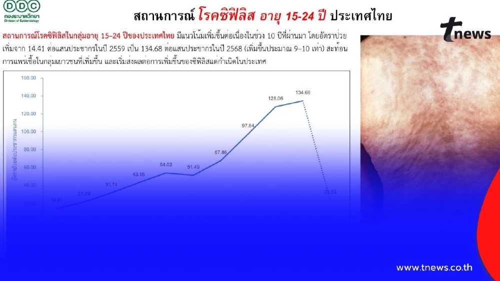 สัญญาณเตือน! ซิฟิลิสในวัยรุ่นไทยพุ่งเกือบ 10 เท่าใน 10 ปี