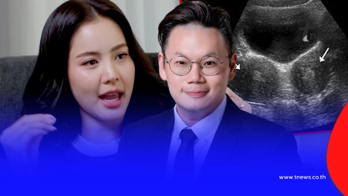 รู้จัก ภาวะ "มดลูกแฝด" ของ "โบว์ เมลดา" บางคนอาจมี แต่ไม่รู้ตัว