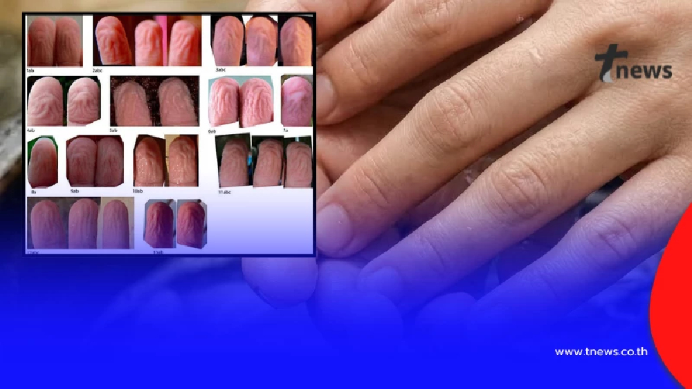 เข้าใจผิดหมด สาเหตุแท้จริง "มือเหี่ยวตอนโดนน้ำ" บอกเลยมันดีมาก