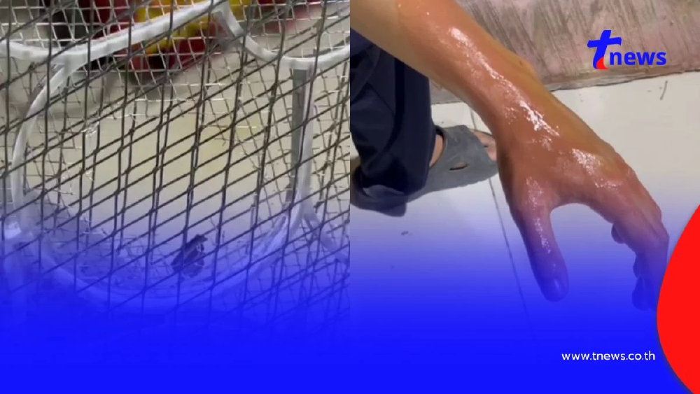 หวิดเสียโฉม! ไม้ตียุง 149 บาทระเบิดใส่หน้าหนุ่ม 18 เจ็บ