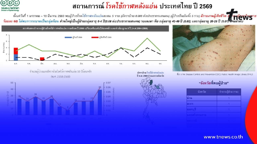 เช็กสถานการณ์ ไข้กาฬหลังแอ่น ปี 2569 พบผู้ป่วย 5 ราย เสียชีวิต 3 ราย