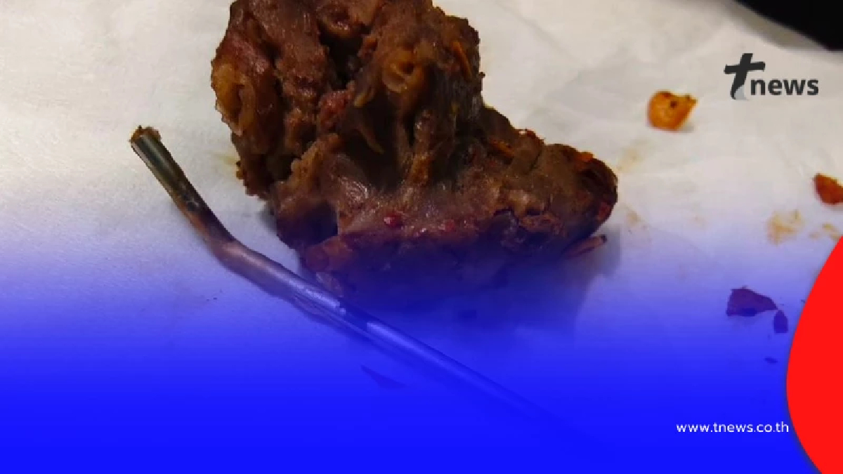 อวสานต้มเนื้อ เกือบเจ็บหนัก ตักคำแรกไม่เป็นไร คำต่อไปเจอดี