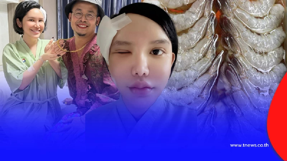 เตือนสายกินดิบ กุ้งแช่น้ำปลาทำพิษ สาวกิน2วันติด ต้องผ่าตัดด่วน