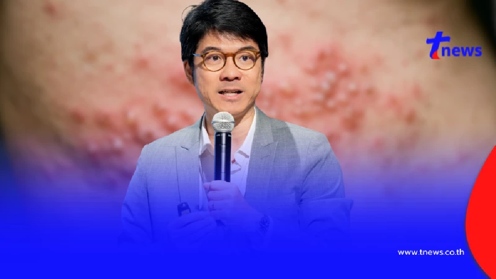 เปิดวิธีป้องกัน “งูสวัด” ที่ดีที่สุด โรคนี้อันตรายกว่าที่คิด