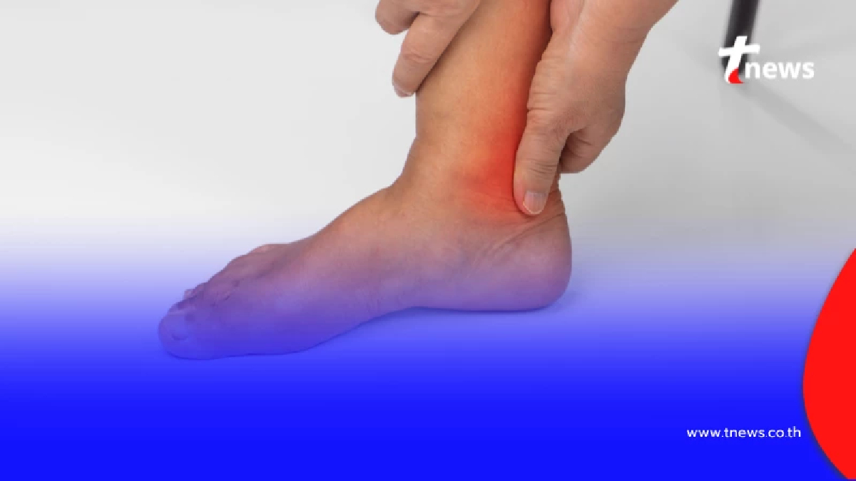 เช็ก 6 สัญญาณอาการชาปลายมือเท้า บอกความเสี่ยงสุขภาพที่ต้องรู้