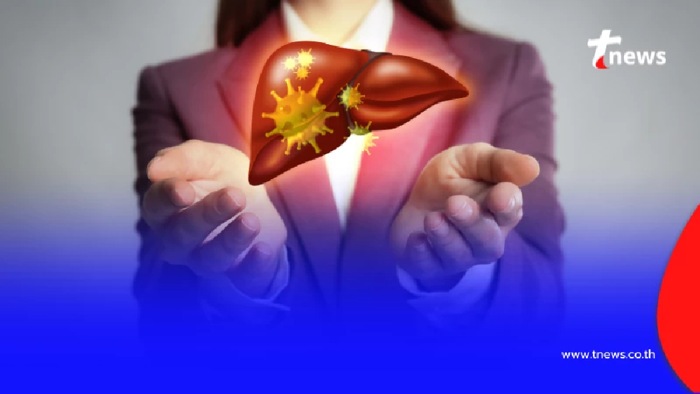 แค่กินร่วมกันก็ติด ยอดปี 69 พุ่ง 651 ราย วัยทำงานเสี่ยงสุด