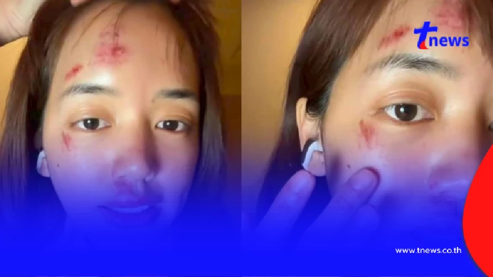 เห็นแล้วตกใจ พลอย พิกกะพลอย เผยสาเหตุหน้าเยิน หลังล่องเรือใน ตปท.