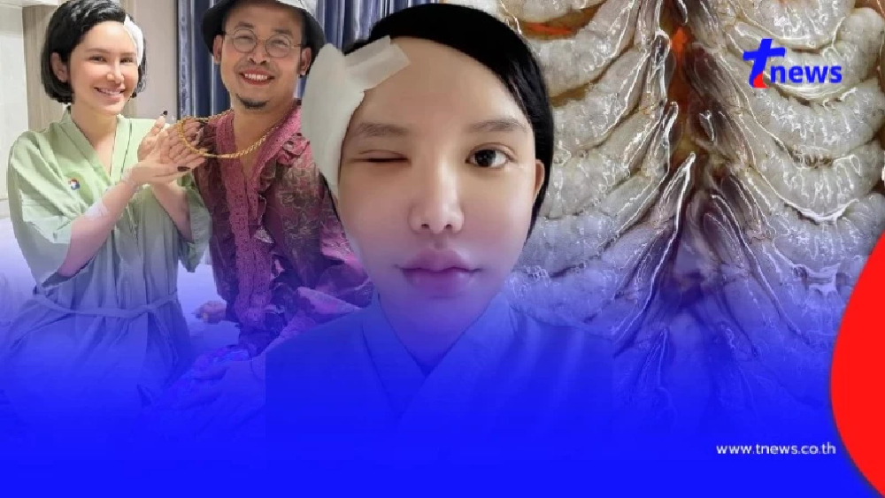 เตือนสายกินดิบ กุ้งแช่น้ำปลาทำพิษ สาวกิน2วันติด ต้องผ่าตัดด่วน