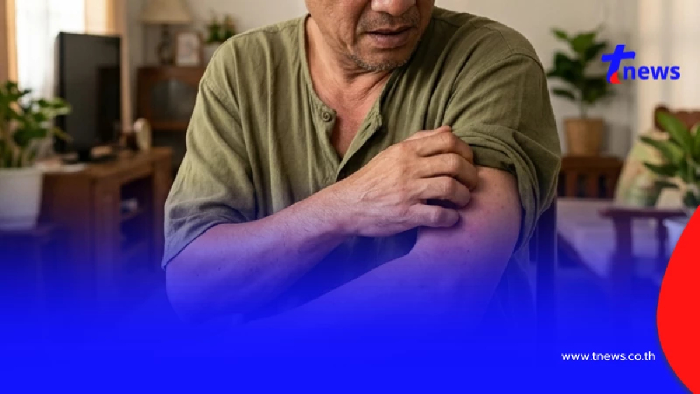 นั่นไง รู้แล้ว "อาการคัน" แบบไหน ที่เป็นจุดเริ่มต้นของ โรคมะเร็ง