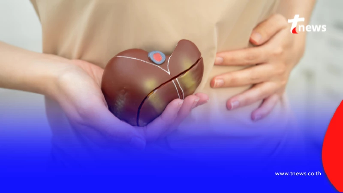 สธ.เตือนตับอักเสบเอระบาด เช็ก 3 สัญญาณเตือน ให้รีบพบแพทย์