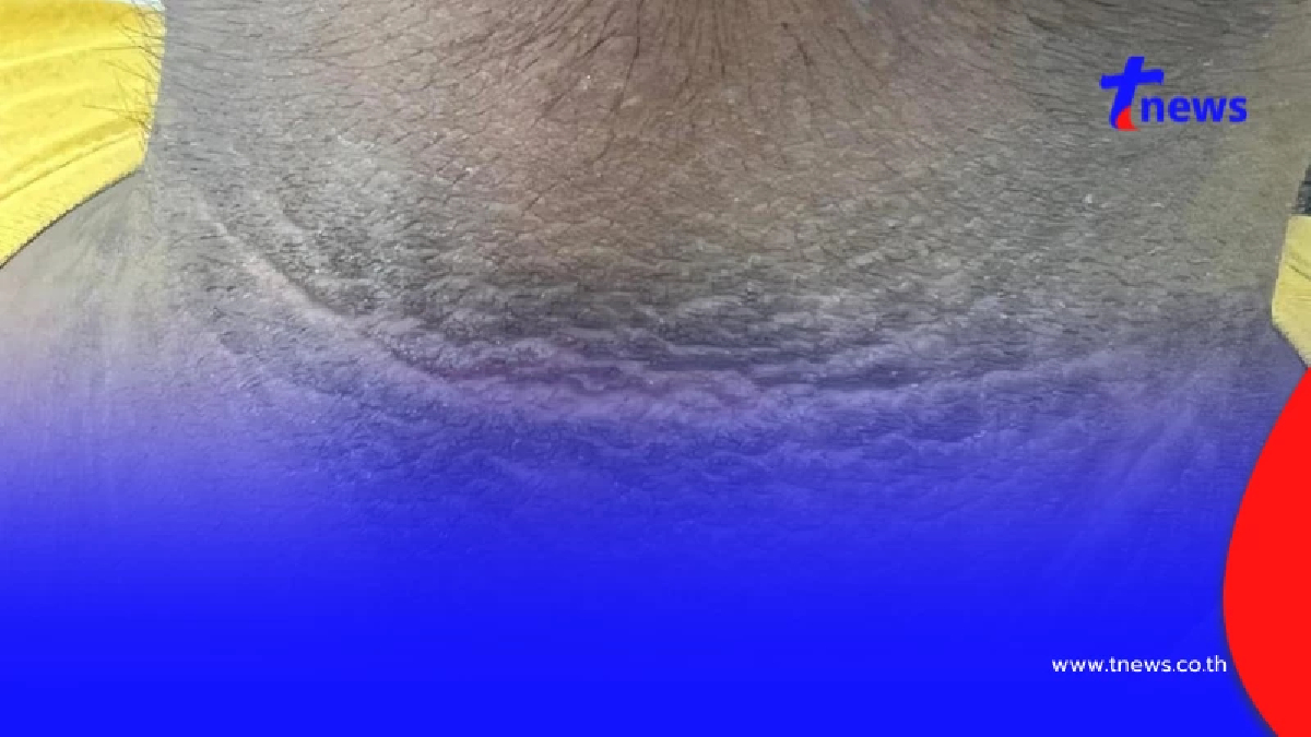 เปิดความจริง คอคาร์บอน แท้จริงคือสัญญาณอันตราย ต้องแก้ให้ตรงจุด