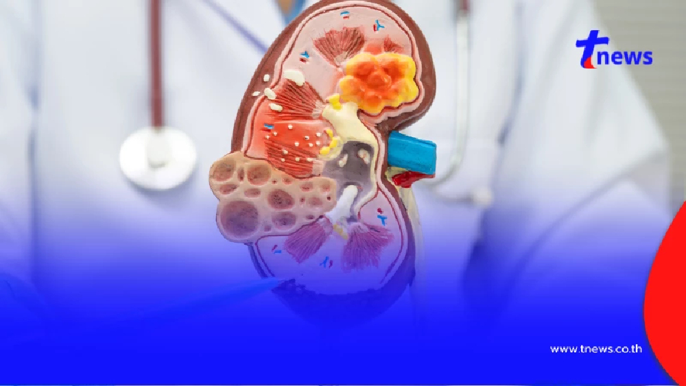 เตือนแล้วนะ! 3 พฤติกรรมเสี่ยง “โรคไต” ทำทุกวันไม่รู้ตัว รู้ก่อนสายเกินแก้