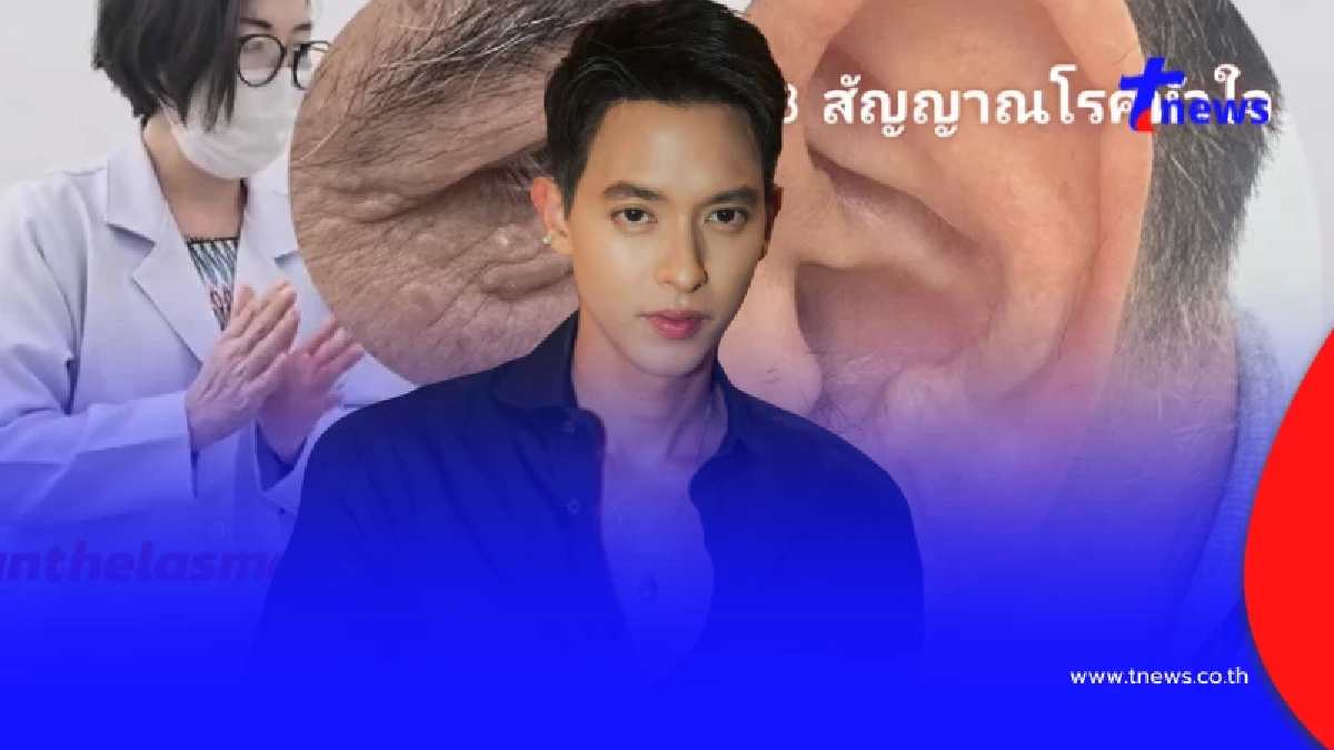 "เจมส์ จิรายุ" เจอเตือนตรงๆ หมอฝากเช็ก 3 อาการ หลังคอเลสเตอรอลพุ่ง