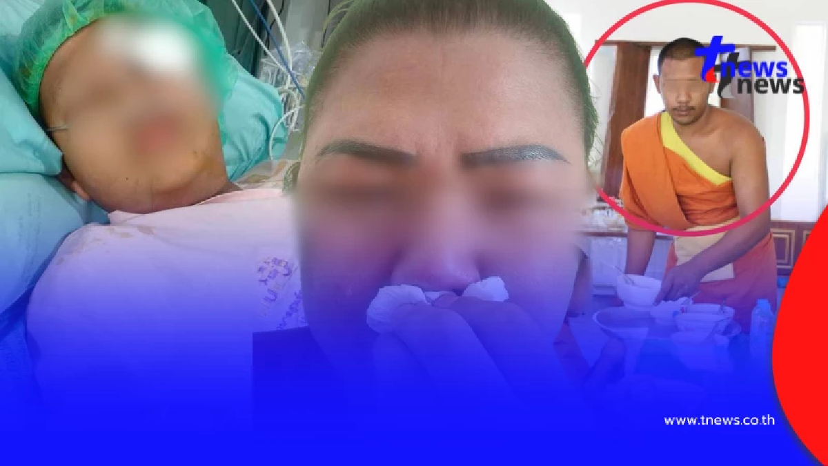 แม่สุดช้ำ พระพี่เลี้ยงทำร้ายเณร 10 ขวบ กระดูกใบหน้าหัก คดีไม่คืบ