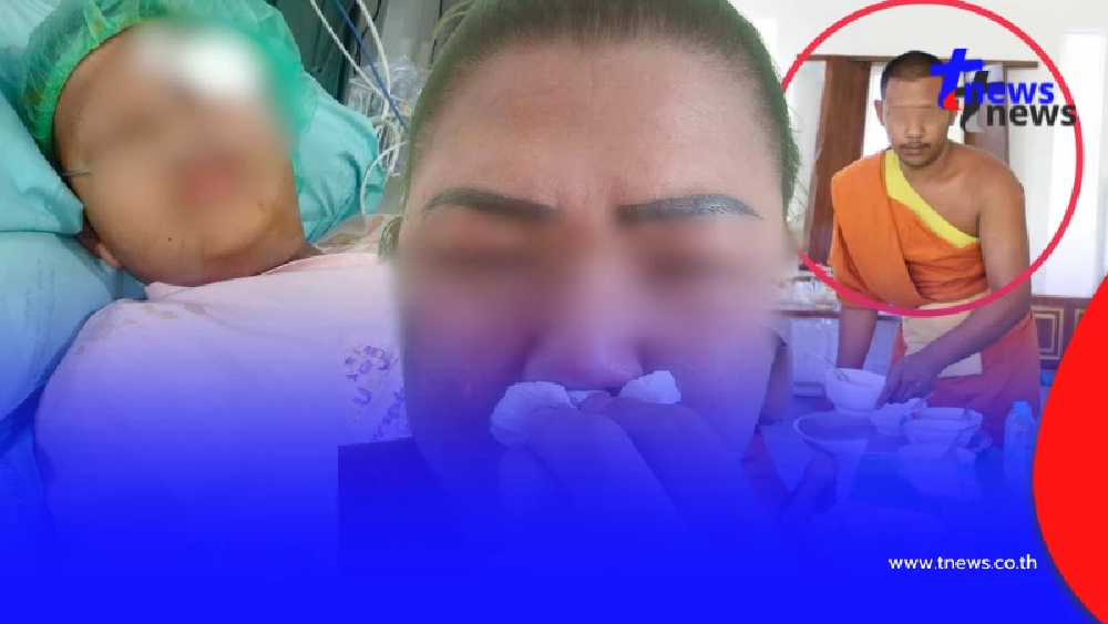 แม่สุดช้ำ พระพี่เลี้ยงทำร้ายเณร 10 ขวบ กระดูกใบหน้าหัก คดีไม่คืบ