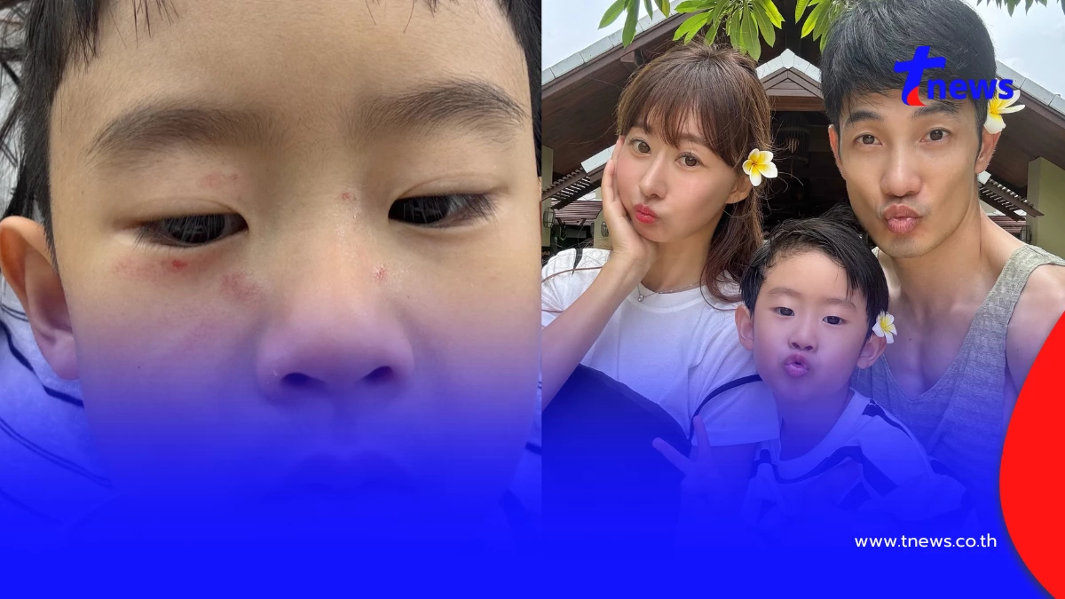 "อ้วน รังสิต" เดือดจัด "น้องโรฮา" โดนเด็กโตข่วนหน้าซ้ำ