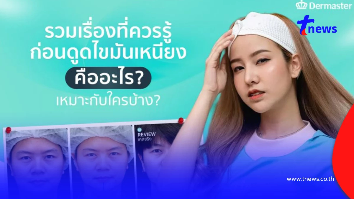 ดูดไขมันเหนียงคืออะไร เหมาะกับใคร มีอะไรที่ต้องรู้ก่อนทำบ้าง?