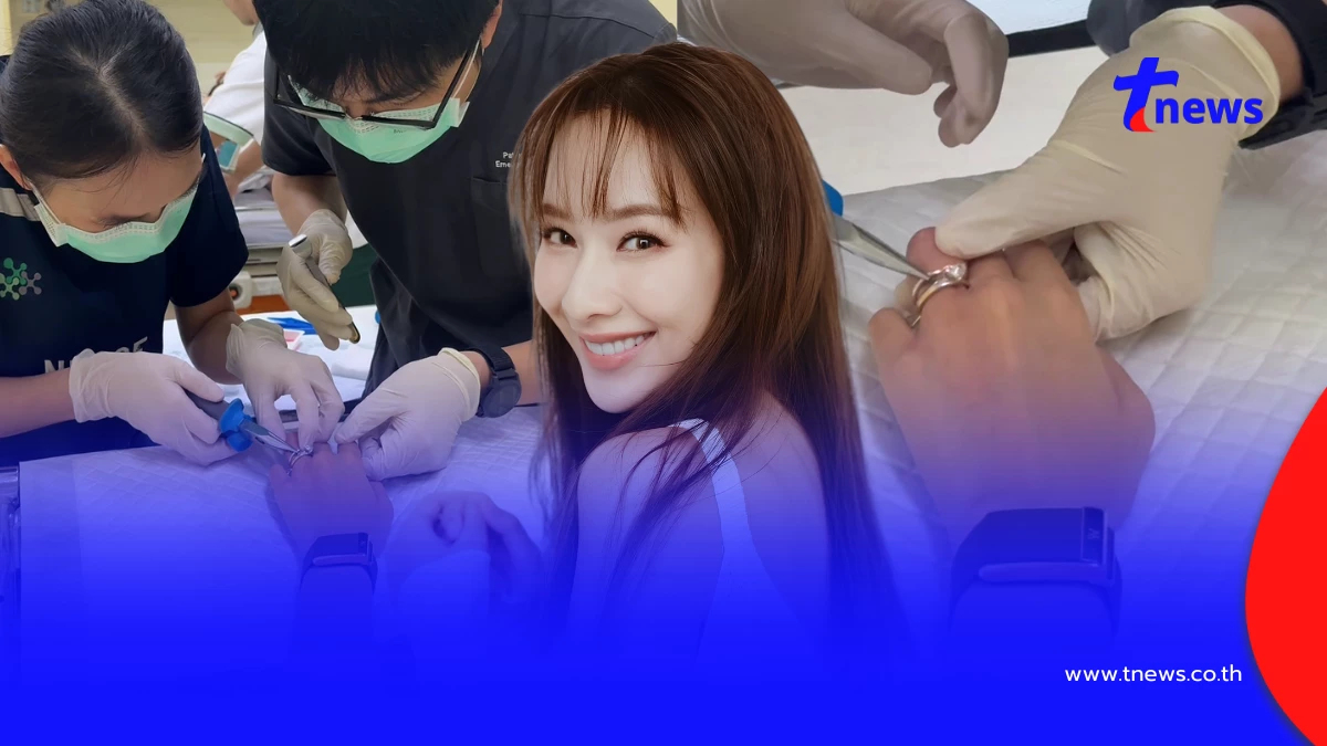 วุ่นทั้งโรงพยาบาล "มิ้นท์ ณัฐวรา" นิ้วบวม หมอต้องสั่งตัดด่วน