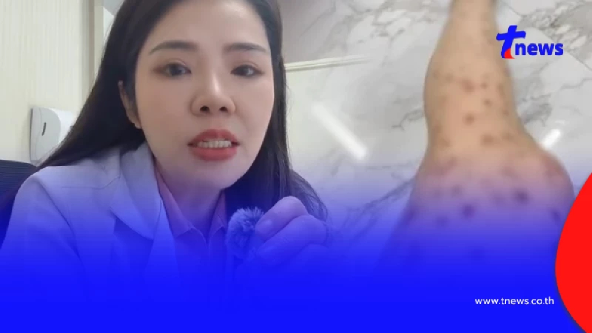 หมอเมย์ เผยสาเหตุแท้จริงสาว HIV ทำนายจ้างซวยติดวัณโรคปอดไปด้วย