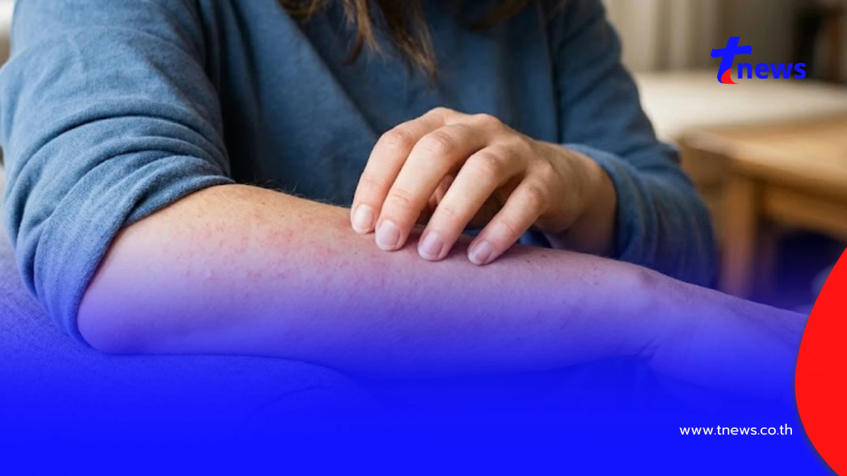 อาการ "ผื่น HIV ระยะแรก" เป็นแบบไหน รีบเช็กก่อนลุกลามไม่รู้ตัว