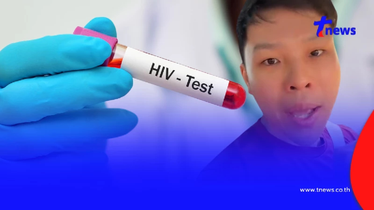 รู้สถิติยิ่งตกใจ "หมอปลูกผม" เผยผลตรวจ HIV หลายคนไม่รู้ตัวมาก่อน