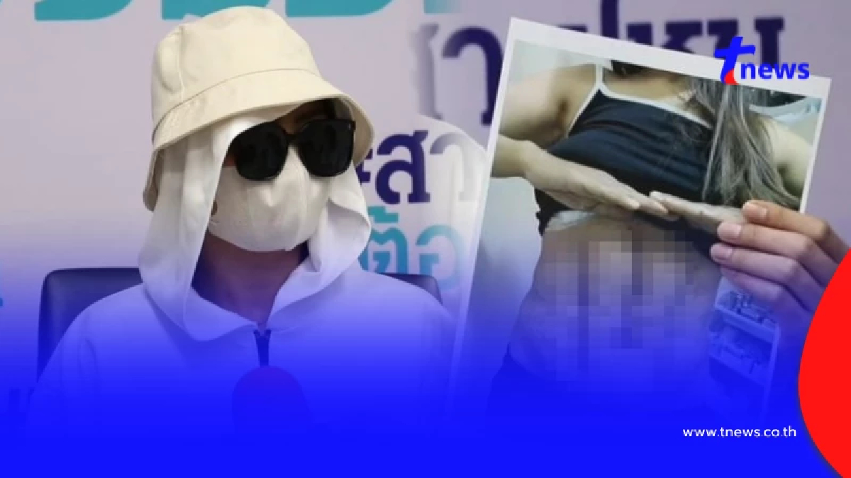 ดูดไขมันสยอง สาว 36 ทำร่อง 11 คลินิกดัง กลายเป็นฝันร้ายตลอดชีวิต