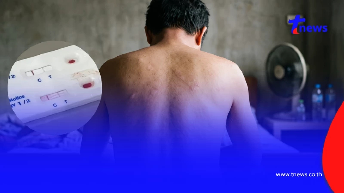 ใครเสี่ยงเช็กด่วน เปิดวิธีตรวจ HIV รู้ผลเบื้องต้นด้วยตัวเอง