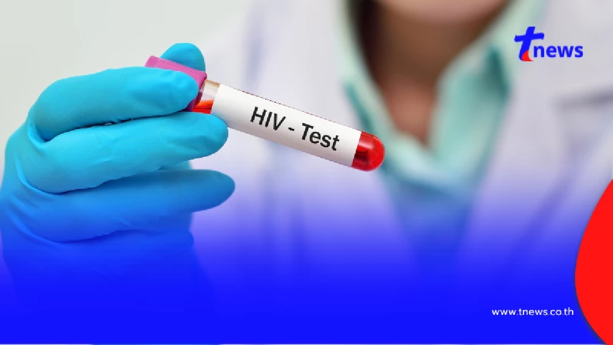 เปิดจังหวัดเสี่ยง พบผู้ติดเชื้อ HIV สะสมทะลุ 23,900 ราย จับตาวัยรุ่นกลุ่มนี้เสี่ยงสุด