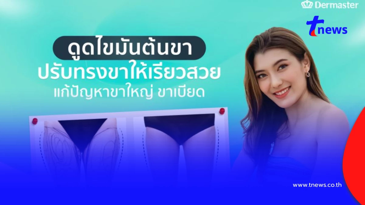 ดูดไขมันต้นขา แก้ขาใหญ่ ขาเบียด ช่วยให้ขาเรียวกระชับสมส่วน