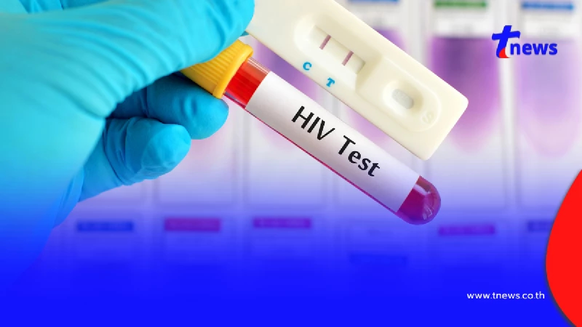 ระวังติด "HIV" ถ้าคุณมีอาการดังนี้ รีบไปหาหมอ ตรวจด่วน