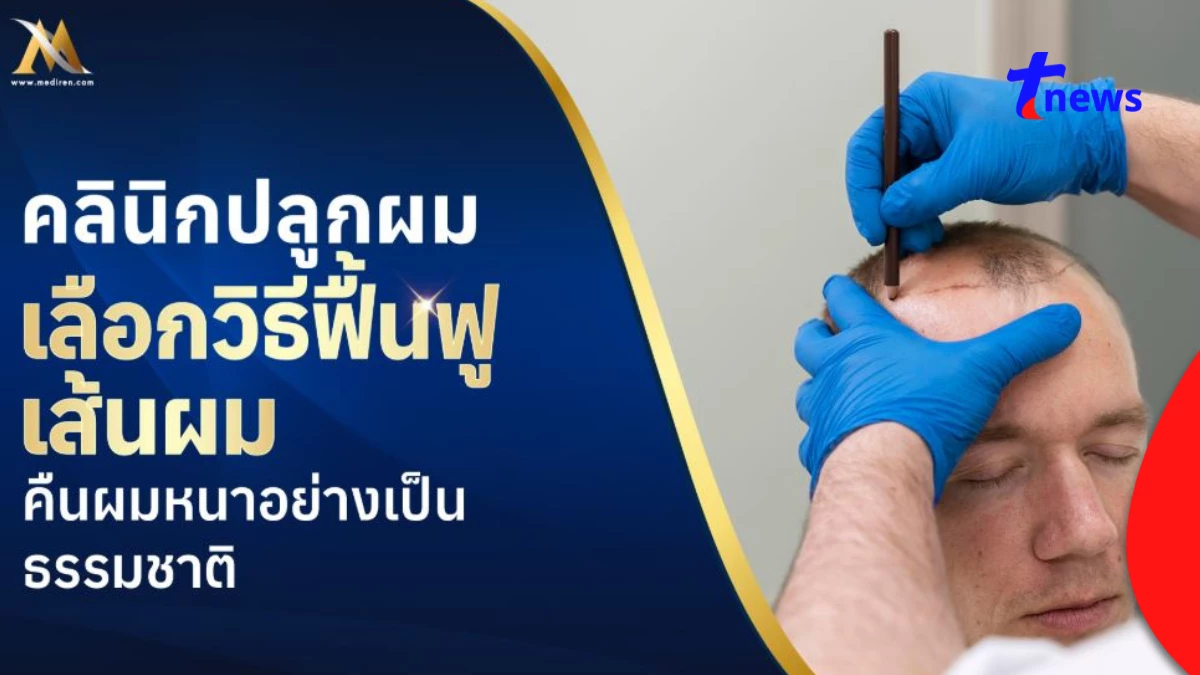 คลินิกปลูกผม ที่ไหนดี? ฟื้นฟูผมบาง คืนผมหนาดูเป็นธรรมชาติ