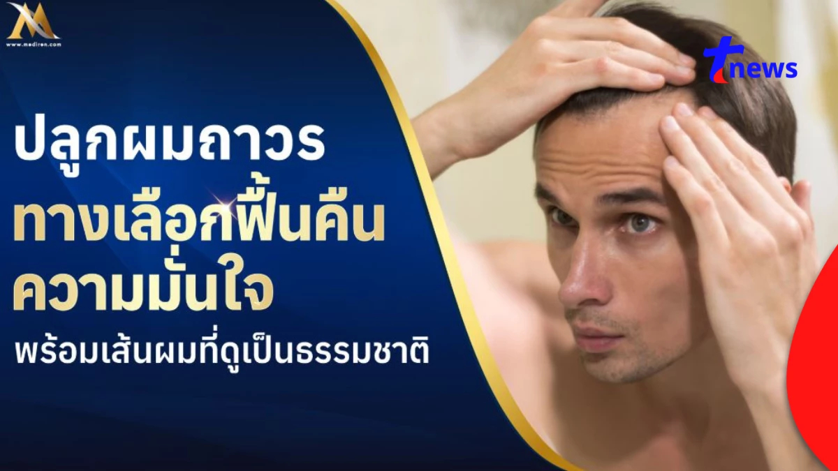 ปลูกผมถาวร คืออะไร? ทางเลือกฟื้นฟูผมร่วง ผมบางอย่างมั่นใจ